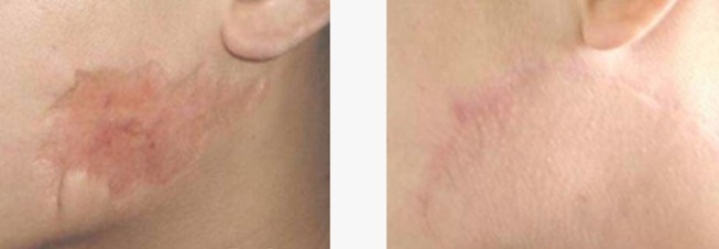 Apolomed Spectra 6 10