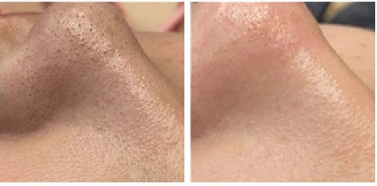 2026-01-21 at 11.37.42 AM