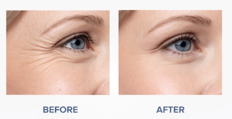 1c519cd4-4bcb-49d8-b2c0-ed18385a9593